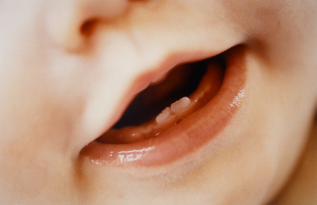 Erucpión dental